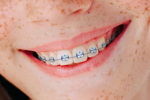 Lightforce brackets